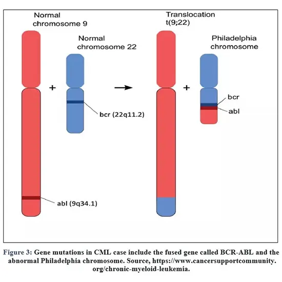 BCR-ABL Gene Translocation (Quantitative)